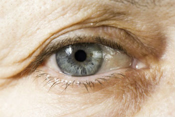 Eye Vitamins for Macular Degeneration