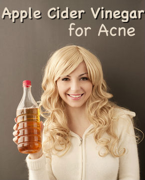 Apple Cider Vinegar for Acne