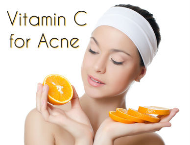 Vitamin C for Acne