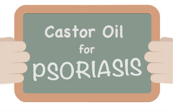 Castor Oil for Psoriasis